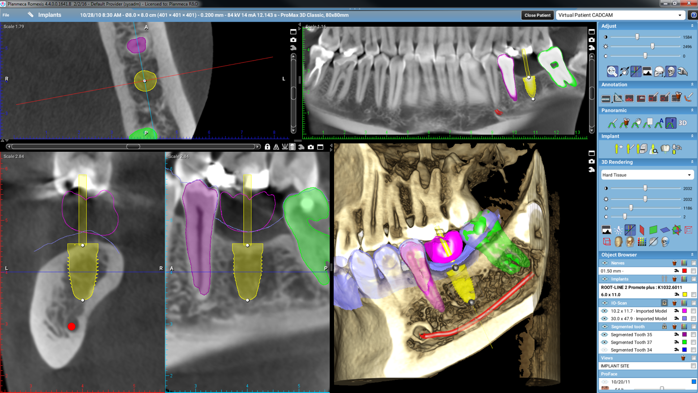 PlanMeca Impression 3D